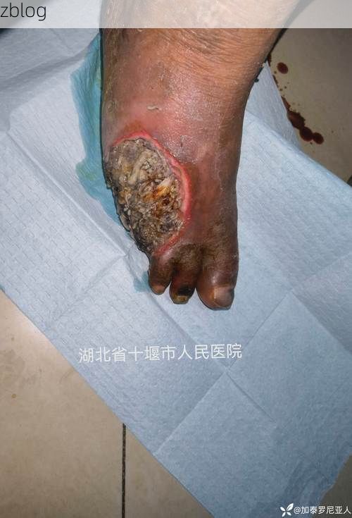 广西河池：喀斯特峰丛屏障下的低感染样本