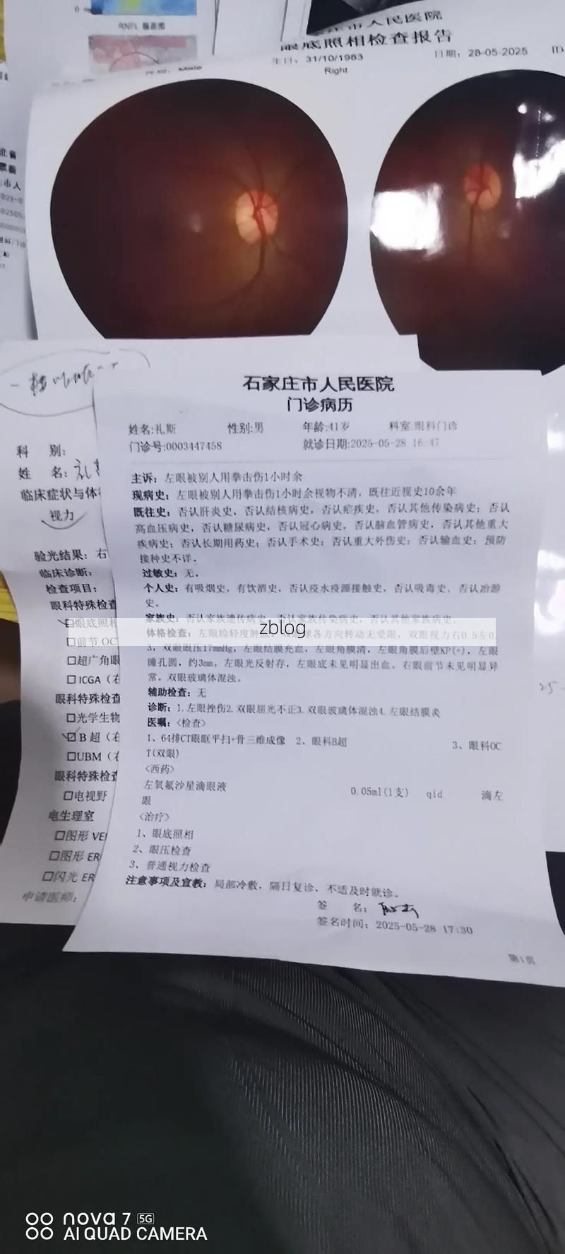 2022年11月25日内蒙古阿鲁科尔沁旗新增确诊病例情况_15519