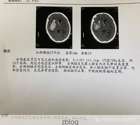 2022年5月10日湟中县新增确诊病例情况