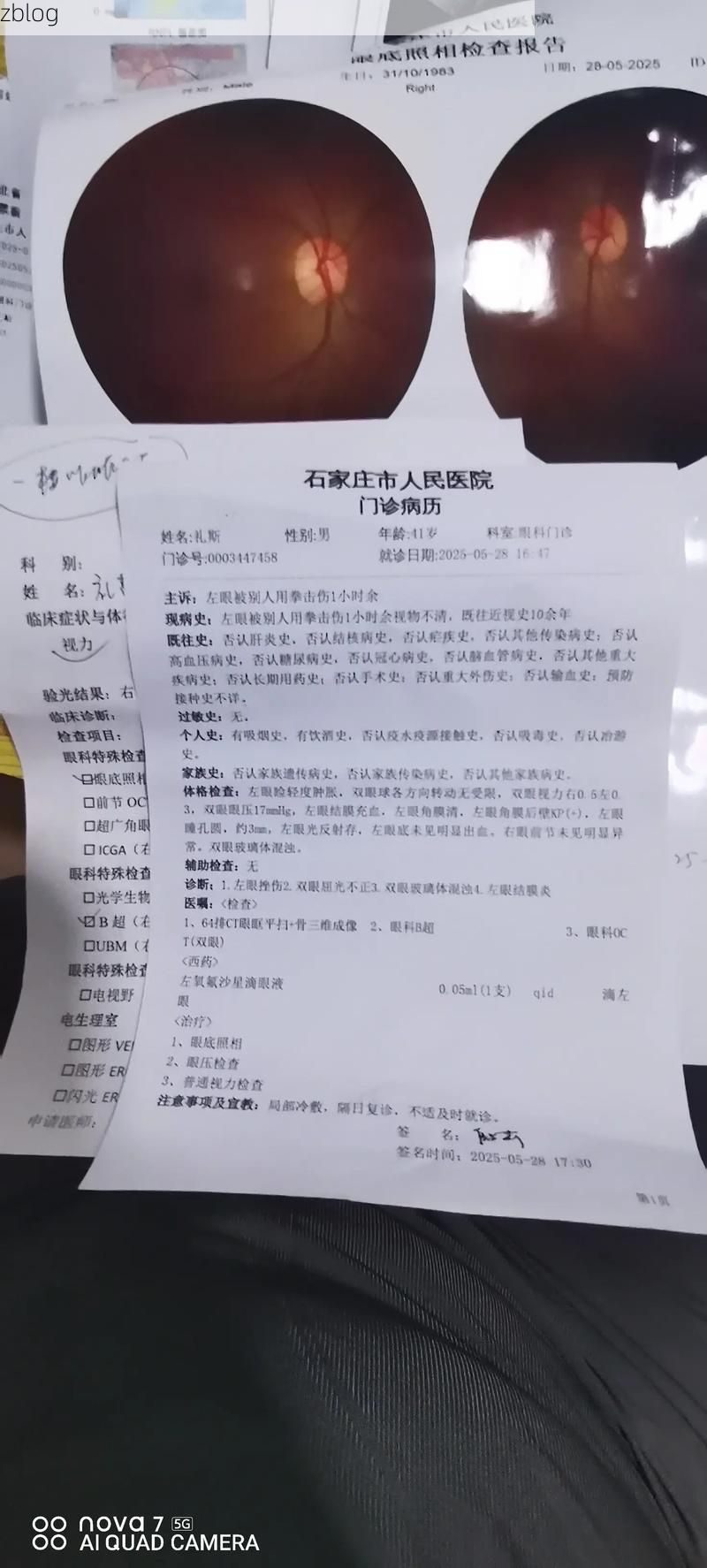 2022年9月28日会理县新增确诊病例情况_6245