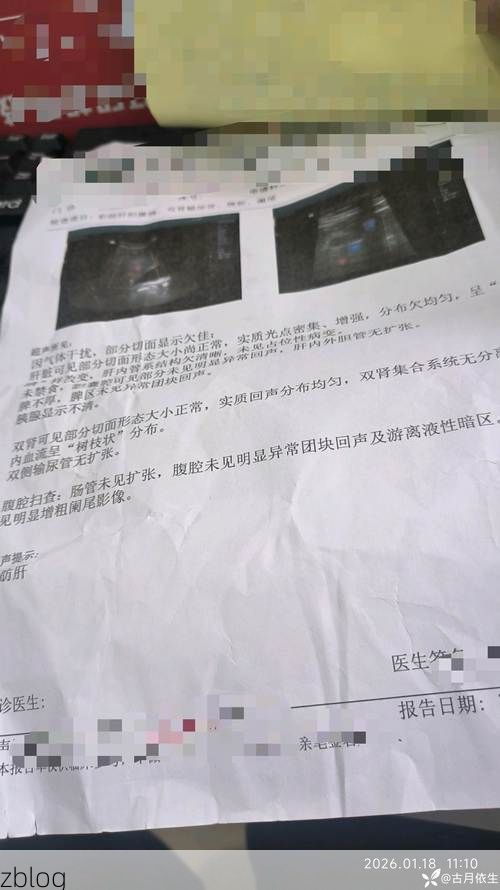 2022年11月23日什邡新增确诊病例情况_12294