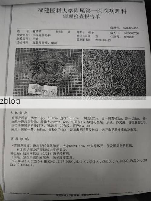 2022年11月28日昌宁县新增确诊病例情况