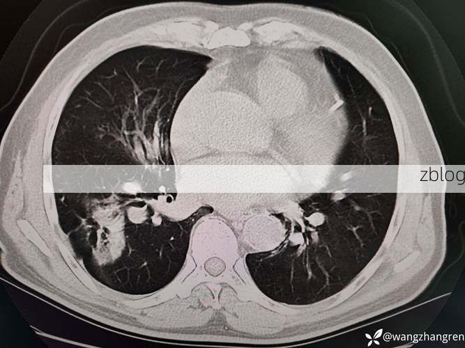 尼勒克：天山屏障下的零感染样本