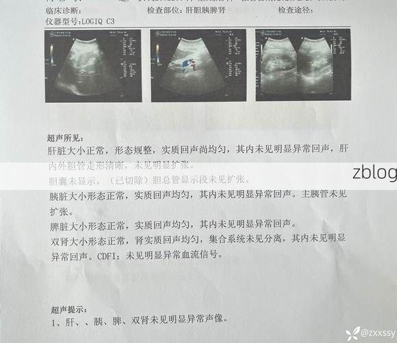 2022年4月1日郎溪县新增确诊病例情况
