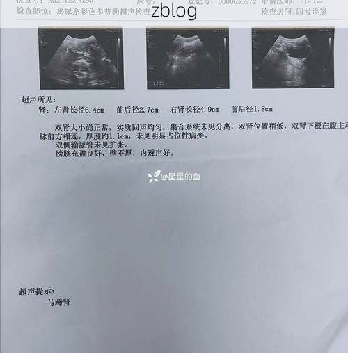 2022年11月28日马边新增确诊病例情况_62173