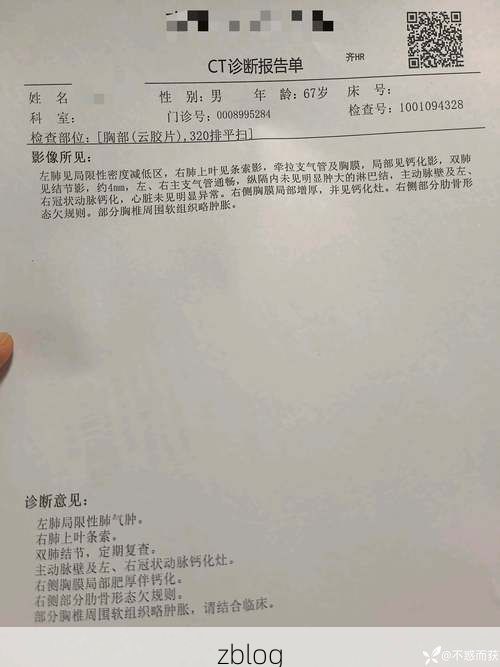 2022年11月27日景德镇新增确诊病例情况_32313