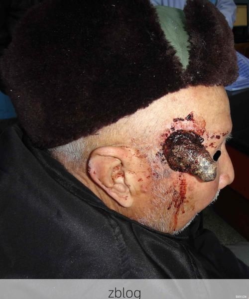 永德：滇西南山城屏障下的零感染样本