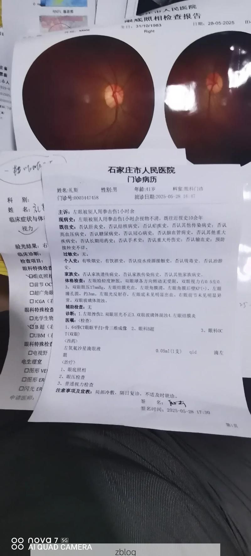2022年11月25日临泉县新增确诊病例情况_52479