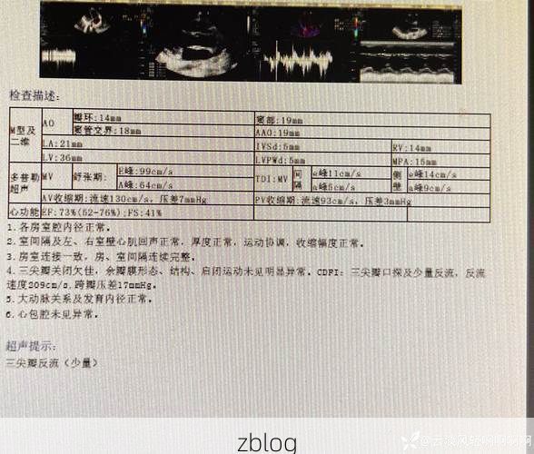 2022年11月25日德江新增确诊病例情况