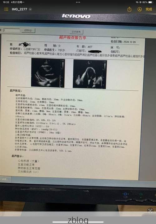 2022年9月20日平坝新增确诊病例情况_28805