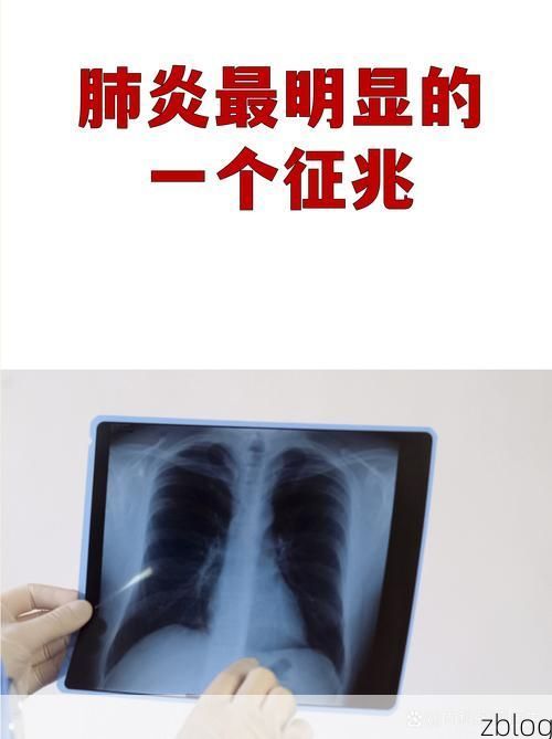 【图木舒克市新增1例无症状感染者  图木舒克市疫情防控工作最新通报_63544】
