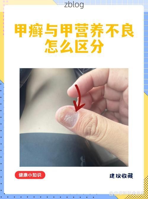 江川防疫样本:高原湖泊屏障下的低感染率成因解析